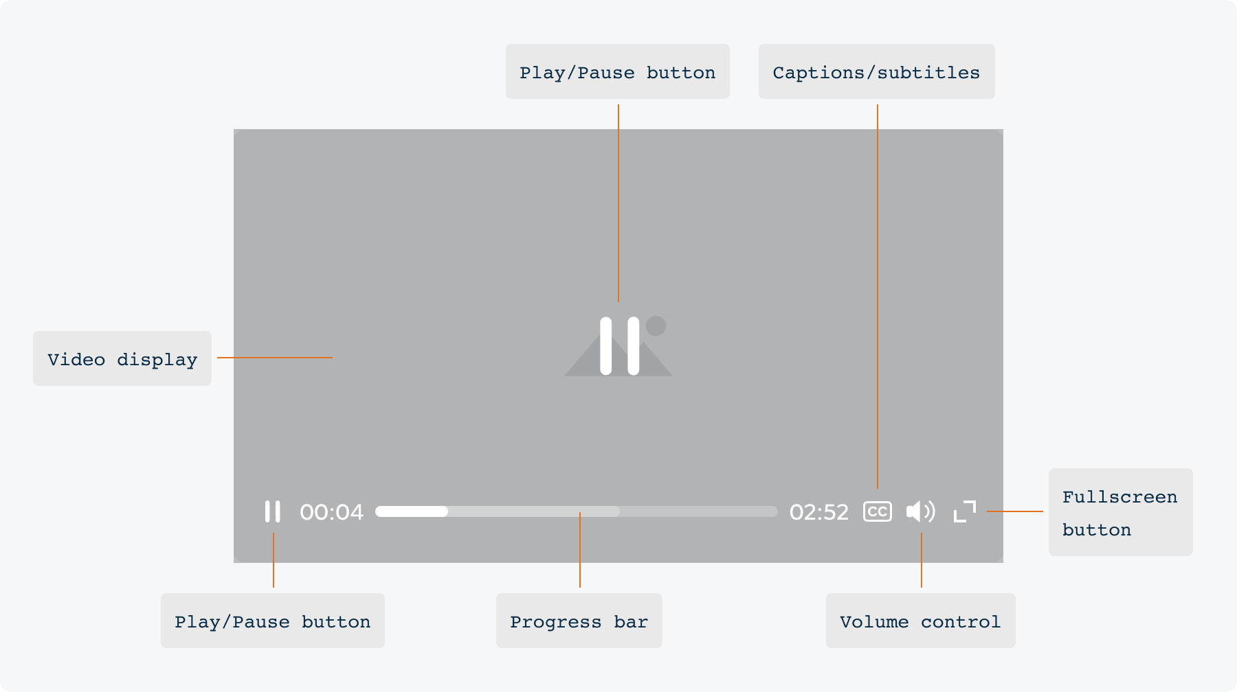 Overview Video player / Anatomy - KL