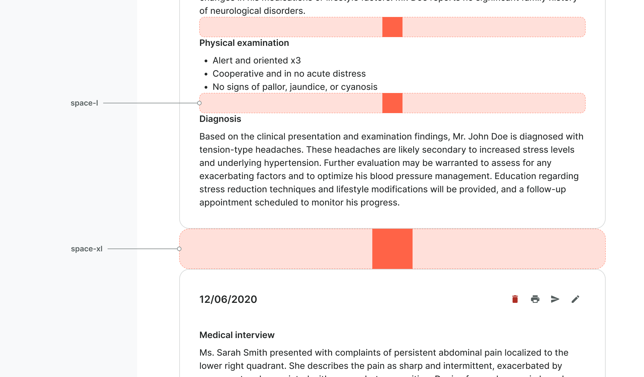 large-and-extralarge-sample